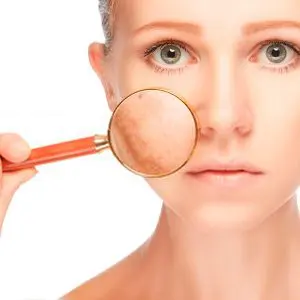 Tractament facial anti-taques